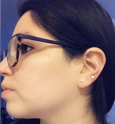 Helix piercing with titanium stud