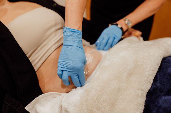 CoolSculpting a patient's abdomen at Columbia Laser Skin Center