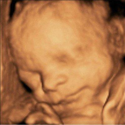 Mommy's Bundle of Joy 4D Ultrasound