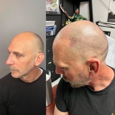 Side profile of my client before and after