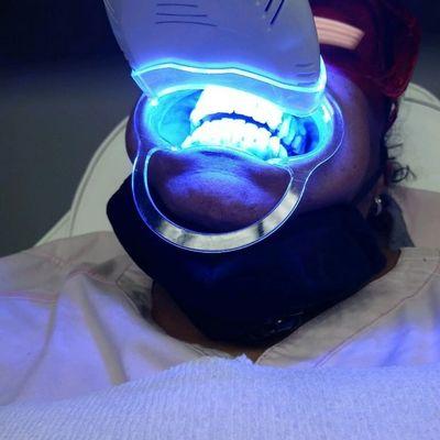 LED TEETH WHITENING