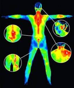 Thermography is a non-invasive imaging procedure for monitoring physical conditions by showing thermal changes present in the body.