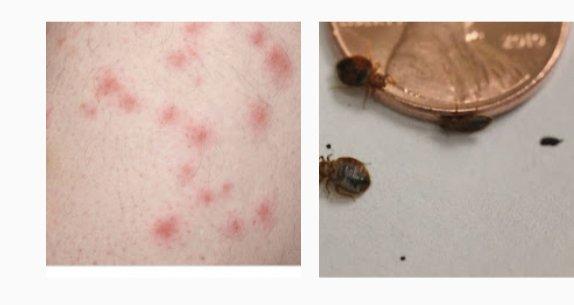 My bed bug bites from this Scottsdale City court.Court Room and waiting area to make payments.You can't fix what you don't admit is there.