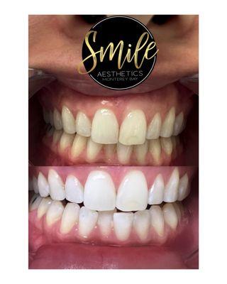 Smile Aesthetics Monterey Bay