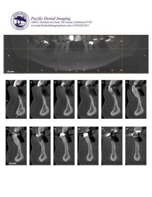 Pacific Dental Imaging