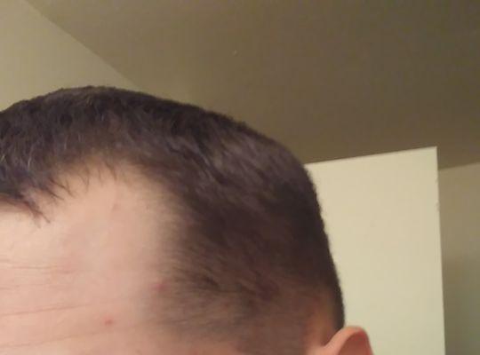 You can see the uneven lines even though I asked for a fade and the left side is way lower than the right.