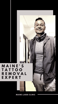 Christoper May - Maine's tattoo removal expert.