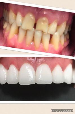 Transformation at Dental Spa Of Broad Street.