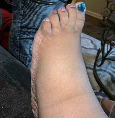 My Foot once I came home from the salon