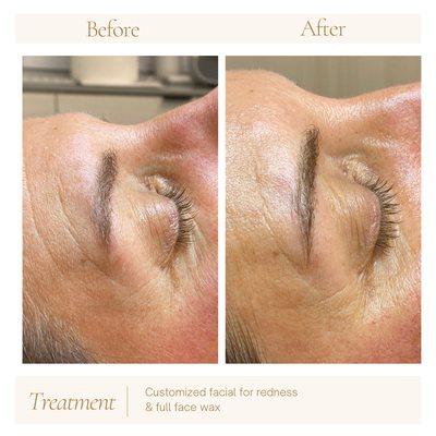 Eyebrow wax, reduced appearance of wrinkles, reduced redness