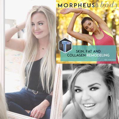 Morpheus8 for collagen remodeling, skin tightening