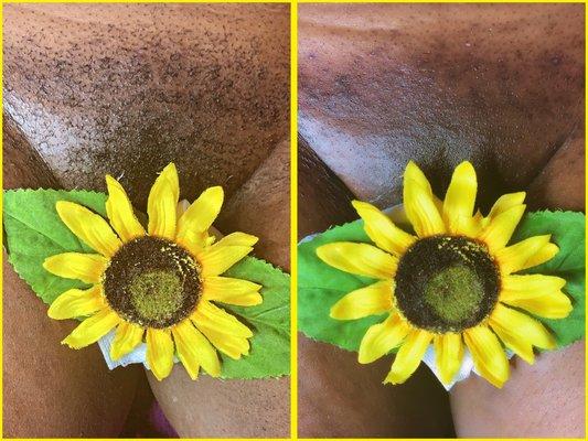 Brazilian Wax (Before and After)