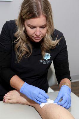 Sclerotherapy treatment