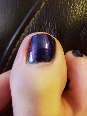 Big toe. I could have screwed this up myself!