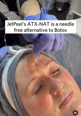 Our exclusive JetPeel oxygen facial!!