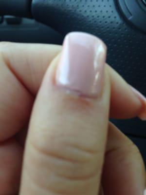 This photo is blurry, but just look carefully at the part that is swollen (bottom right of the nail). That's part she cut me.