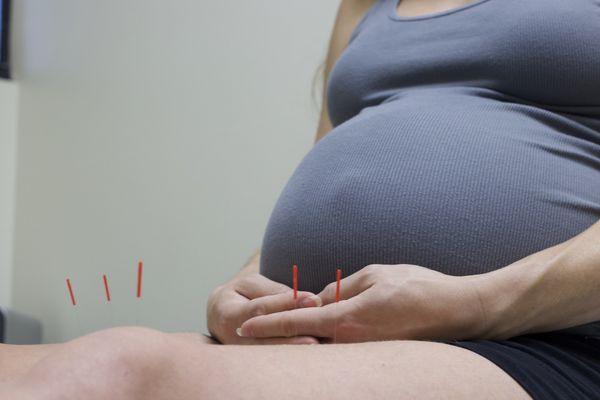 Acupuncture for fertility