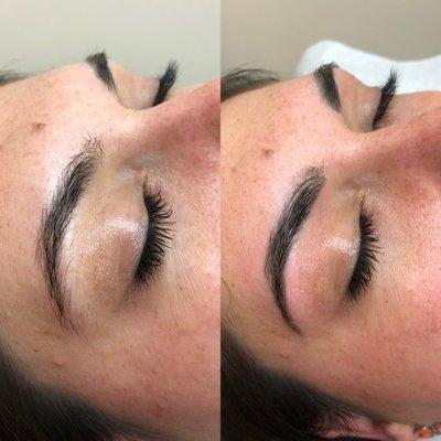 Brow transformation.