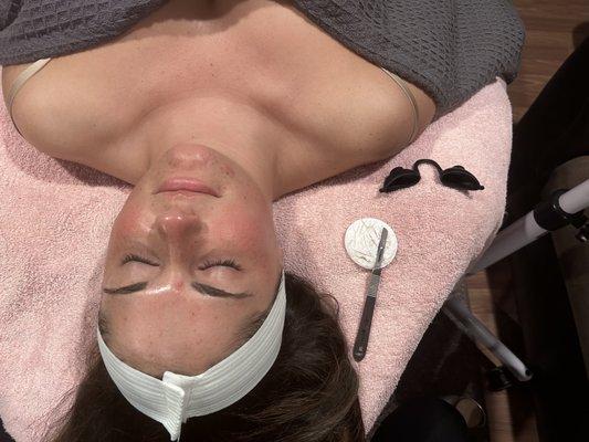 Dermaplaning facial