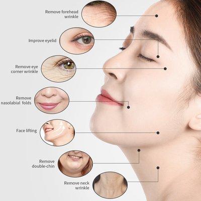 RF Skin Tightening Face Lifting