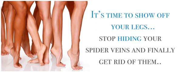 Spider Vein Removal