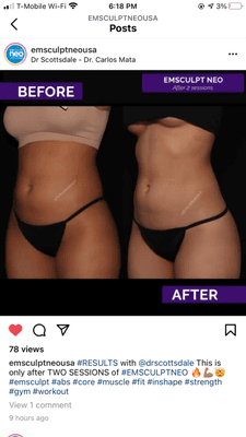 In only 2 sessions - you can already see the results