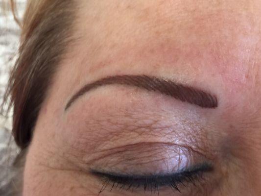 Initial eyebrow. Right after procedure.