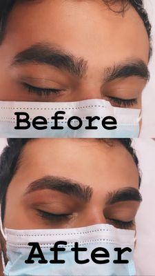 Brow shaping