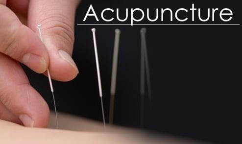 Acupuncture now available at Spa Skin.