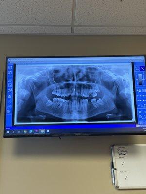 Mayflower Oral Surgery