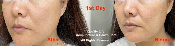 Quality Life Acupuncture & Health Care