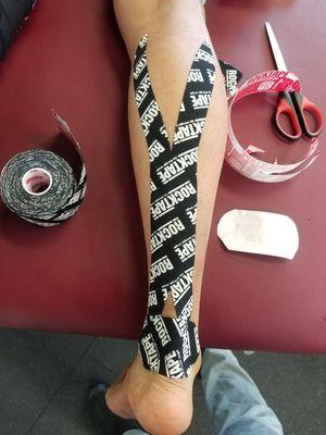 Kinesio Taping to help reduce pain and improve myofascia gliding so you can move better.