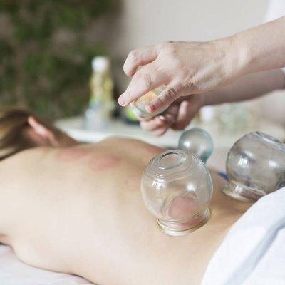 Cupping therapy