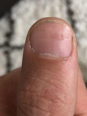 That's not polish, this is how nail nail is reacting to the hack job! DO NOT GO HERE