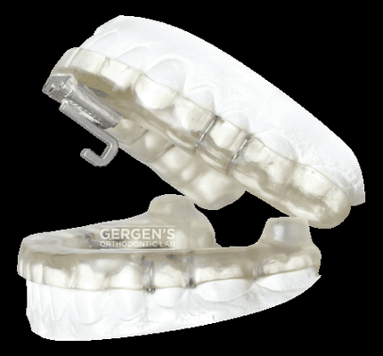 Tap 3 Elite fabricated in the USA by David Gergen from Gergen's Orthodontic Lab