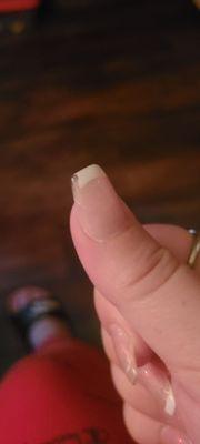 This is the thumb that chipped the very next day.