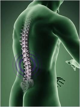 Low back pain, neck pain, sciatica relief using Non-surgical spinal decompression.