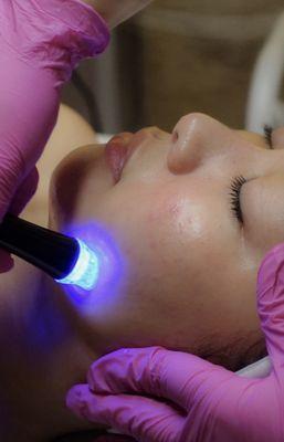 Hydrofacial done by Lydia