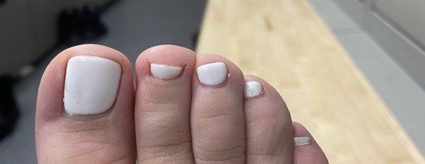 I have never had such crooked toe nails in my life