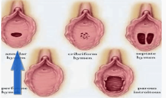 photo of Vagina V.