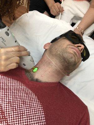 Laser Hair Removal