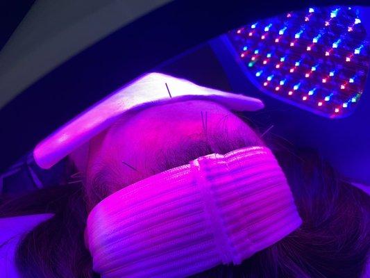 facial acupuncture with polychromatic LED light therapy