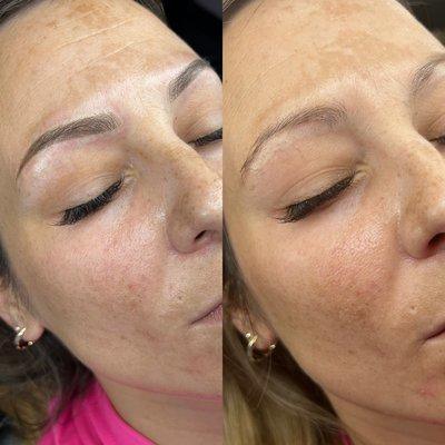 Before and after Microblading