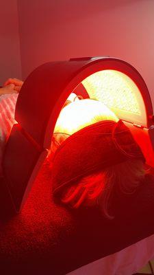 Red light therapy - Stimulates collagen production