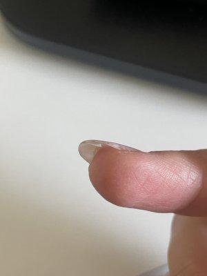 Natural nail peeling/breaking