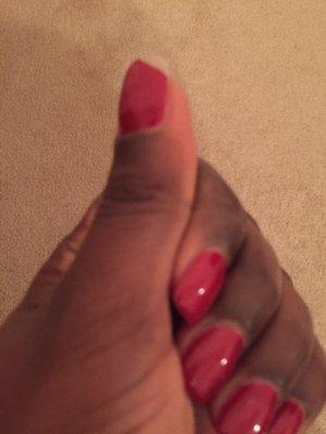 Gel polish peeled off on 2 nails