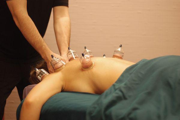 Cupping Therapy