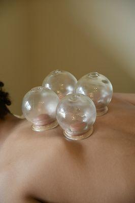 Cupping