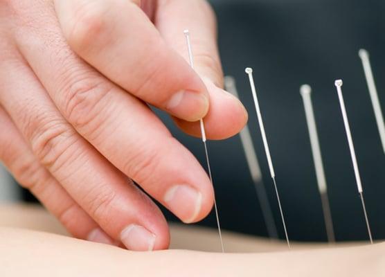 Acupuncture and Oriental Medical Center