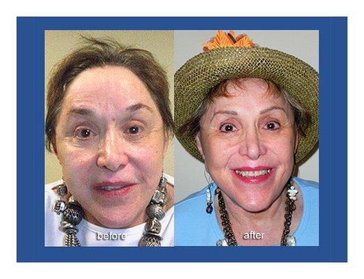 81 y.o. can still be beautiful with permanent makeup!